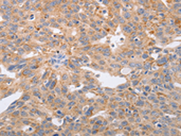Rabbit Polyclonal Antibody to PPP1CB