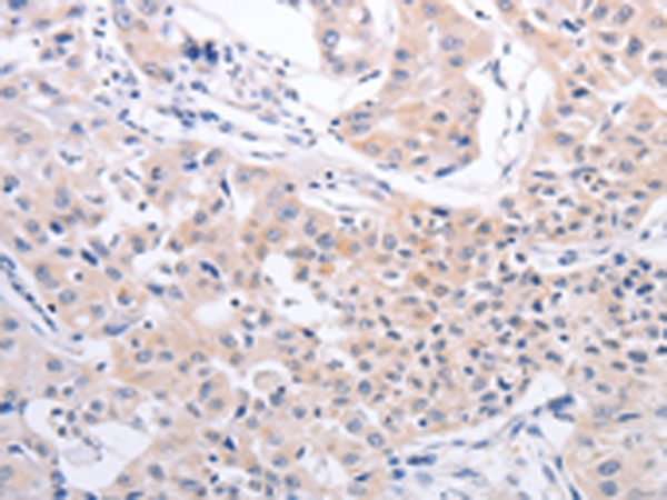 Rabbit Polyclonal Antibody to PFN4