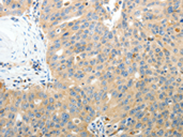 Rabbit Polyclonal Antibody to RAMP3