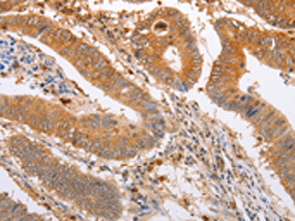 Rabbit Polyclonal Antibody to SERP1