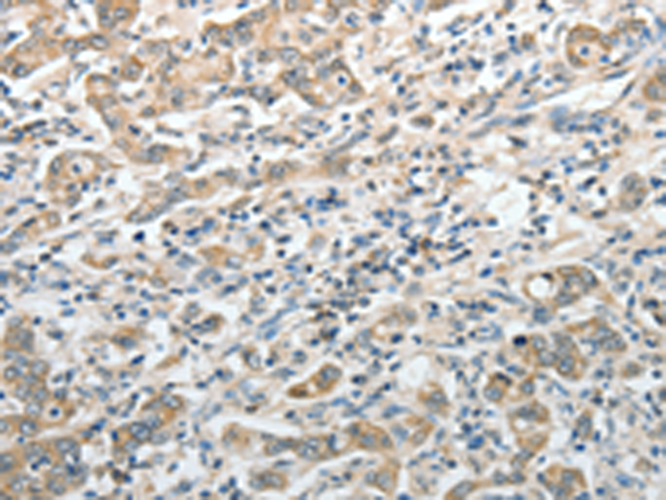Rabbit Polyclonal Antibody to PRMT2