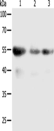 Rabbit Polyclonal Antibody to PRCP