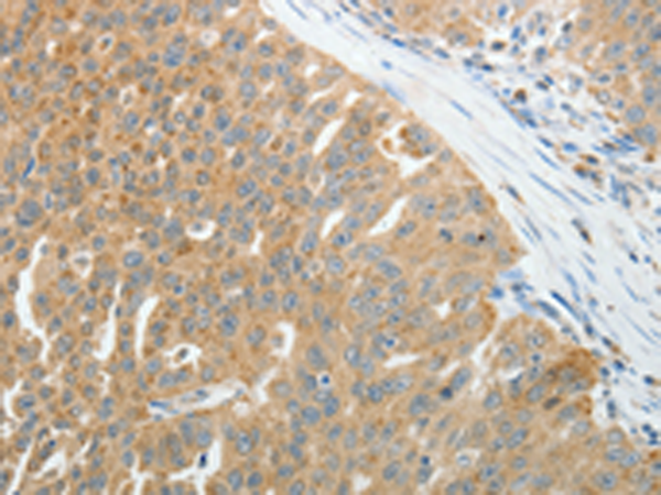 Rabbit Polyclonal Antibody to PRDX5