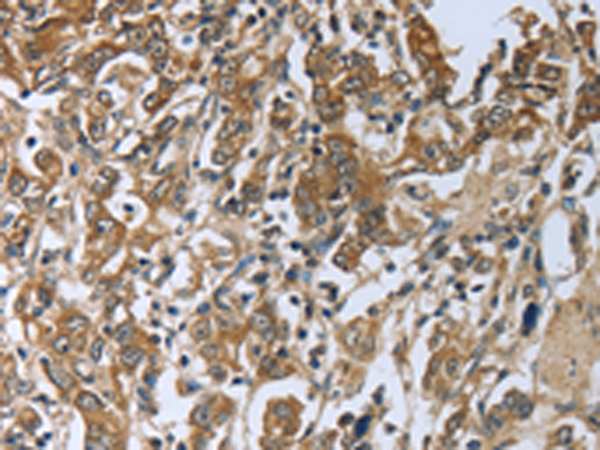 Rabbit Polyclonal Antibody to PRL