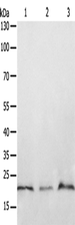 Rabbit Polyclonal Antibody to PTP4A2