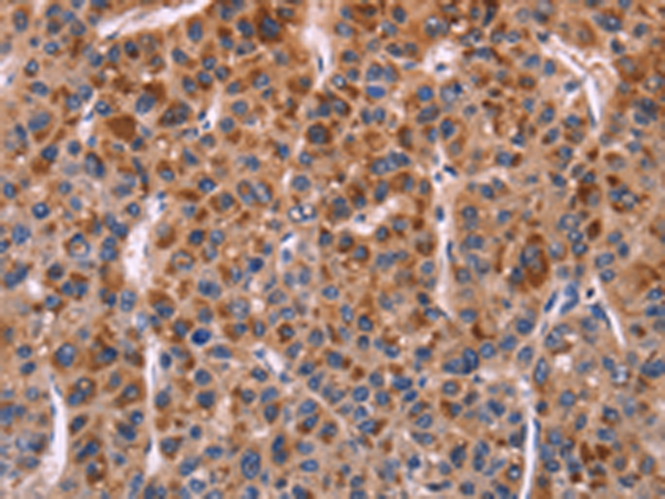 Rabbit Polyclonal Antibody to SELPLG