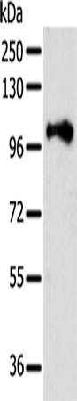 Rabbit Polyclonal Antibody to PSMD2