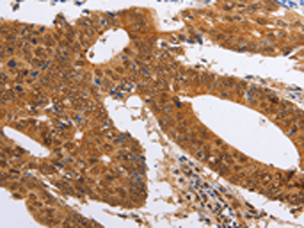 Rabbit Polyclonal Antibody to PSMD8