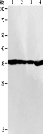 Rabbit Polyclonal Antibody to PSMD14
