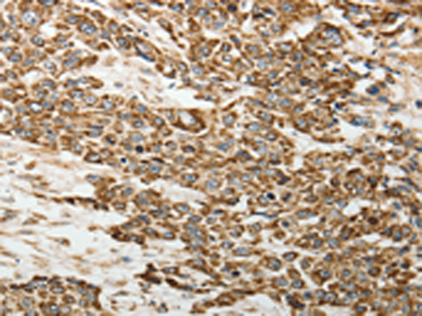 Rabbit Polyclonal Antibody to SELE