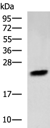 Rabbit Polyclonal Antibody to PTGDS
