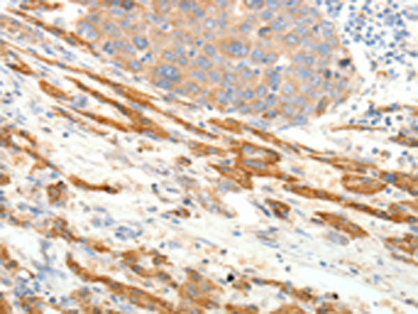 Rabbit Polyclonal Antibody to PTHLH