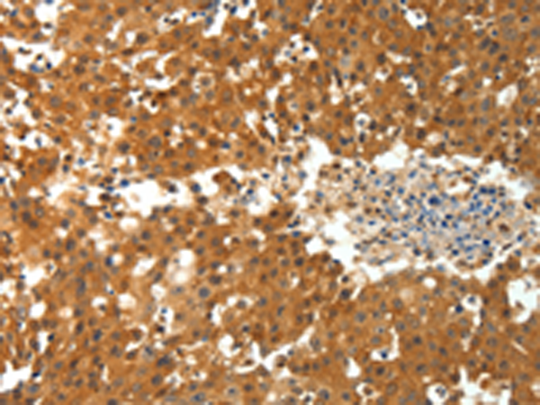 Rabbit Polyclonal Antibody to PTPRE