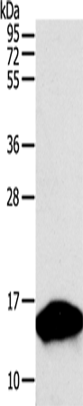 Rabbit Polyclonal Antibody to PVALB