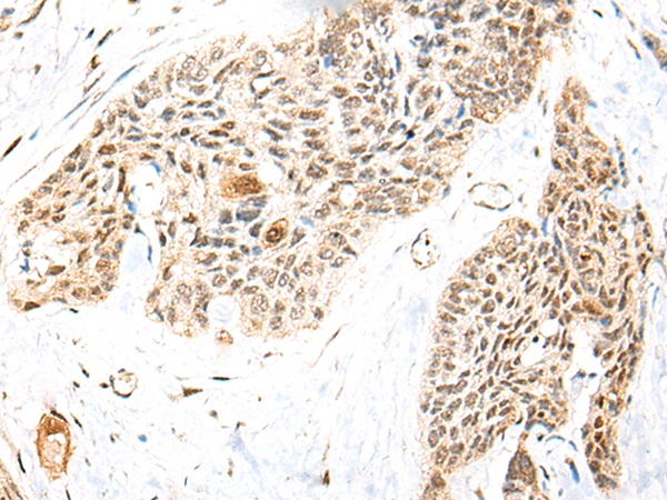 Rabbit Polyclonal Antibody to RBMS2