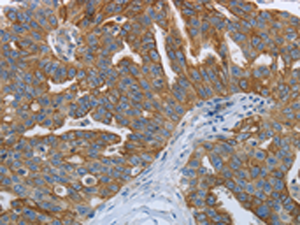 Rabbit Polyclonal Antibody to RETN
