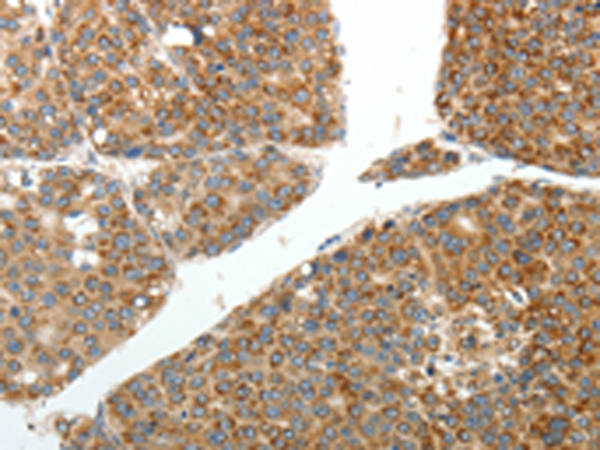 Rabbit Polyclonal Antibody to RETNLB