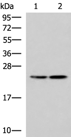 Rabbit Polyclonal Antibody to RGS2
