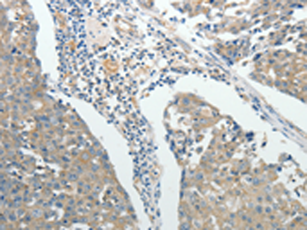 Rabbit Polyclonal Antibody to ROCK1