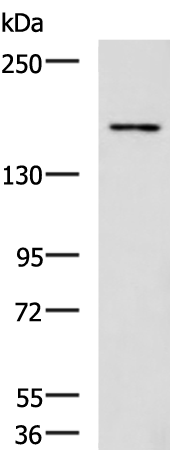 Rabbit Polyclonal Antibody to ROCK2