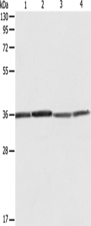 Rabbit Polyclonal Antibody to RPLP0