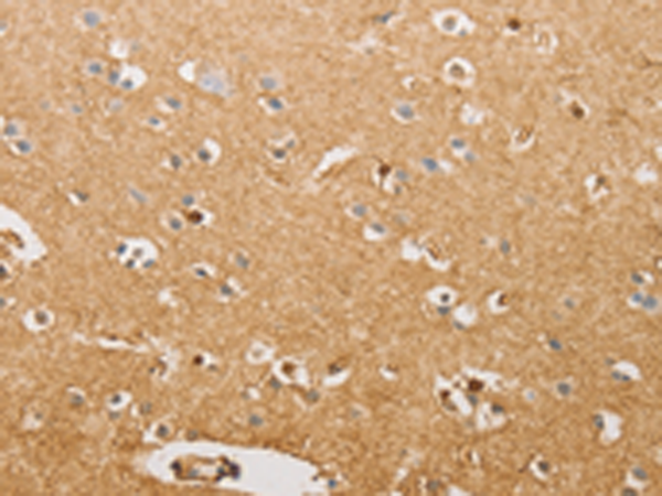Rabbit Polyclonal Antibody to S100A1