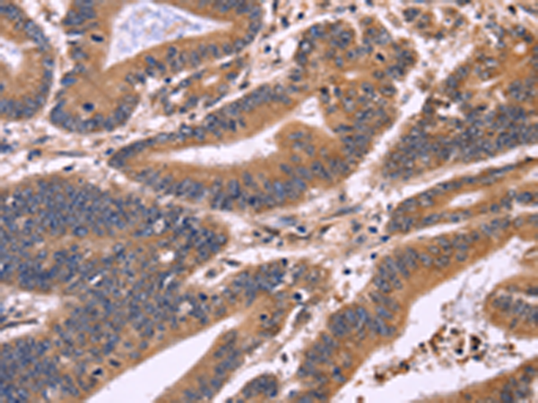 Rabbit Polyclonal Antibody to S100A13