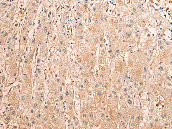 Rabbit Polyclonal Antibody to SEMA3C
