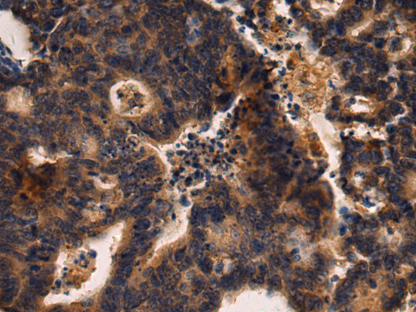 Rabbit Polyclonal Antibody to SEMA3G