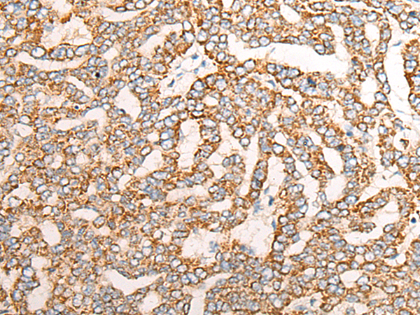 Rabbit Polyclonal Antibody to NR0B2