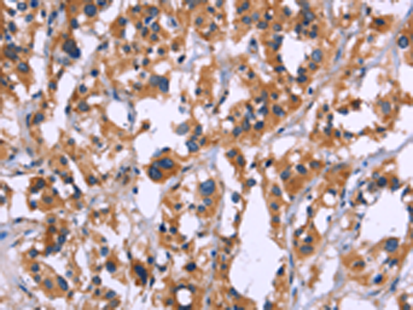 Rabbit Polyclonal Antibody to ZEB2