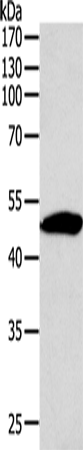 Rabbit Polyclonal Antibody to SIRT6
