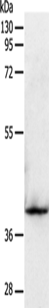 Rabbit Polyclonal Antibody to SIRT2