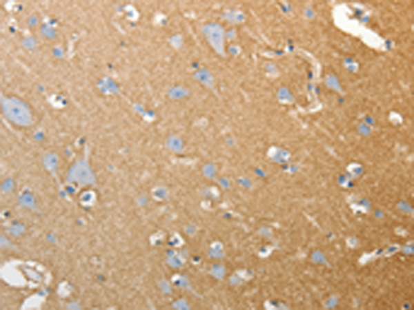 Rabbit Polyclonal Antibody to SLC4A4