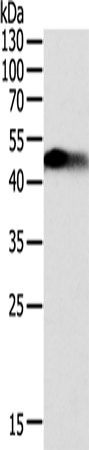 Rabbit Polyclonal Antibody to SLC12A1