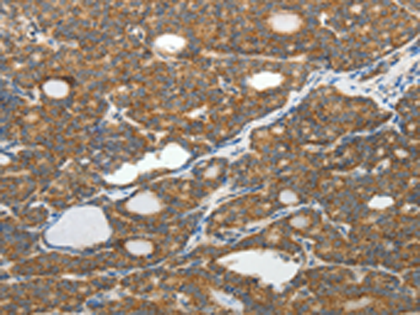Rabbit Polyclonal Antibody to SLC12A4
