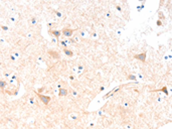 Rabbit Polyclonal Antibody to SLC19A2