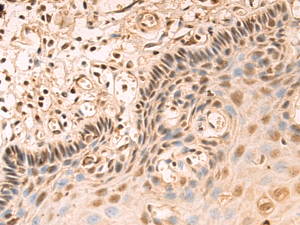 Rabbit Polyclonal Antibody to SNAI2