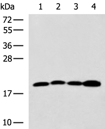 Rabbit Polyclonal Antibody to TAGLN2