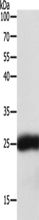 Rabbit Polyclonal Antibody to SNAP25