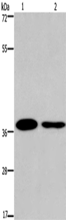Rabbit Polyclonal Antibody to SNAI1