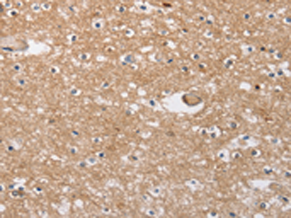 Rabbit Polyclonal Antibody to SOCS2