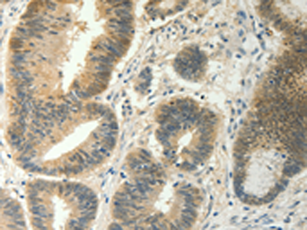 Rabbit Polyclonal Antibody to SOCS5
