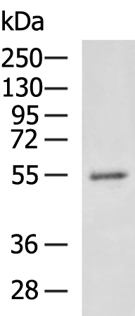 Rabbit Polyclonal Antibody to SOCS6