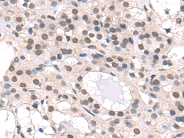 Rabbit Polyclonal Antibody to SOD1
