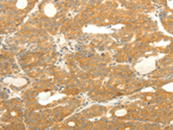 Rabbit Polyclonal Antibody to SOX2
