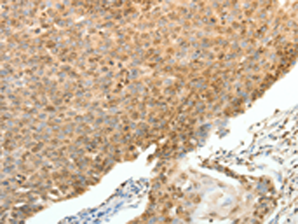 Rabbit Polyclonal Antibody to SPAG8