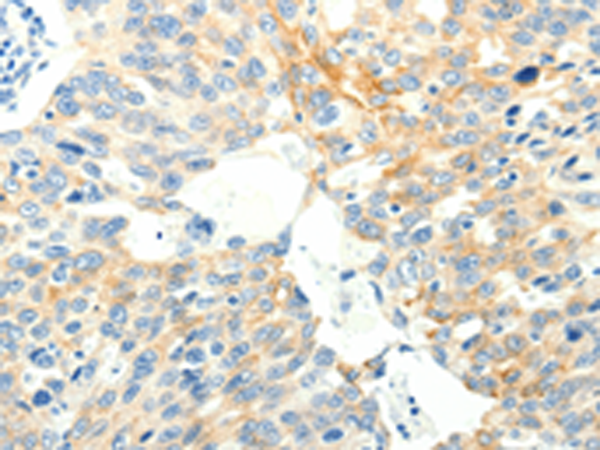 Rabbit Polyclonal Antibody to SPAG5