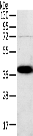 Rabbit Polyclonal Antibody to SPARC