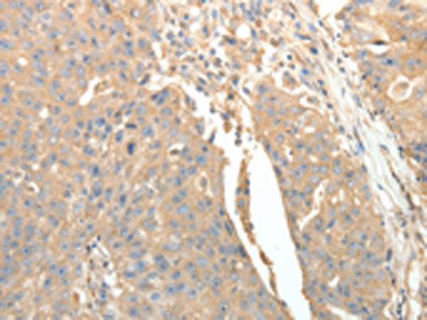 Rabbit Polyclonal Antibody to SFTPD